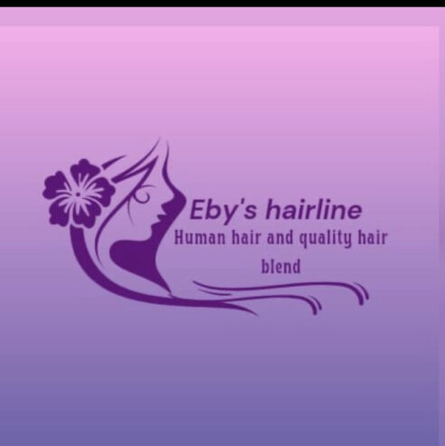 Eby’s_hairline