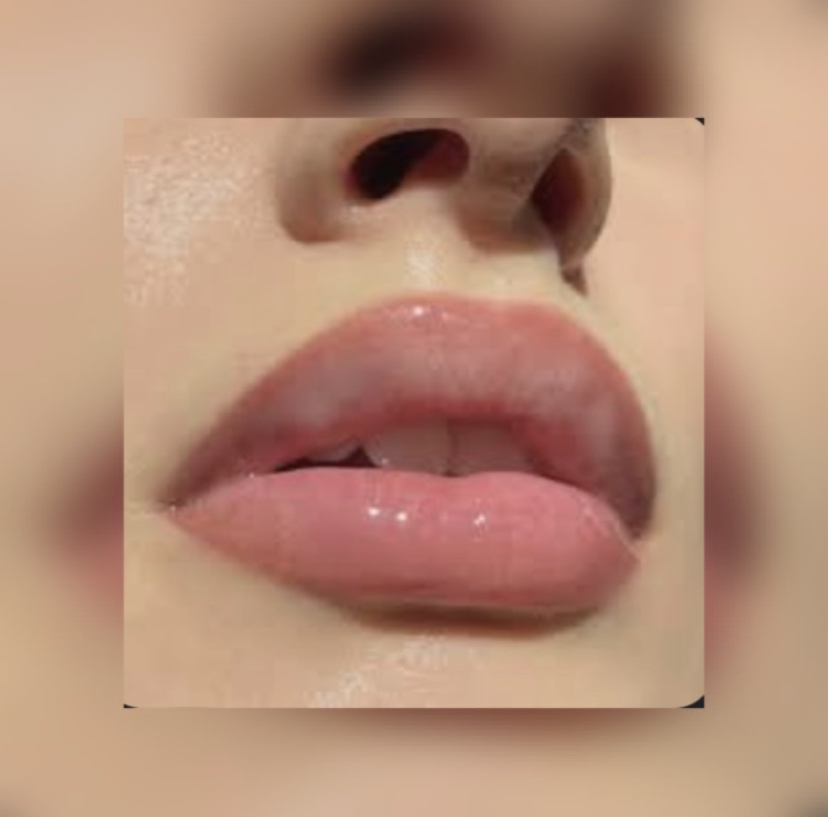 FIZZY SMOOCH