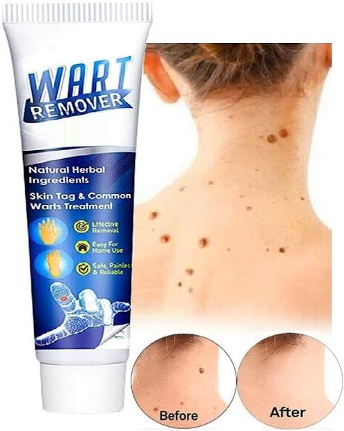 Unisex wart removal ointments